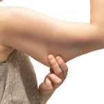 female arm with bingo wings